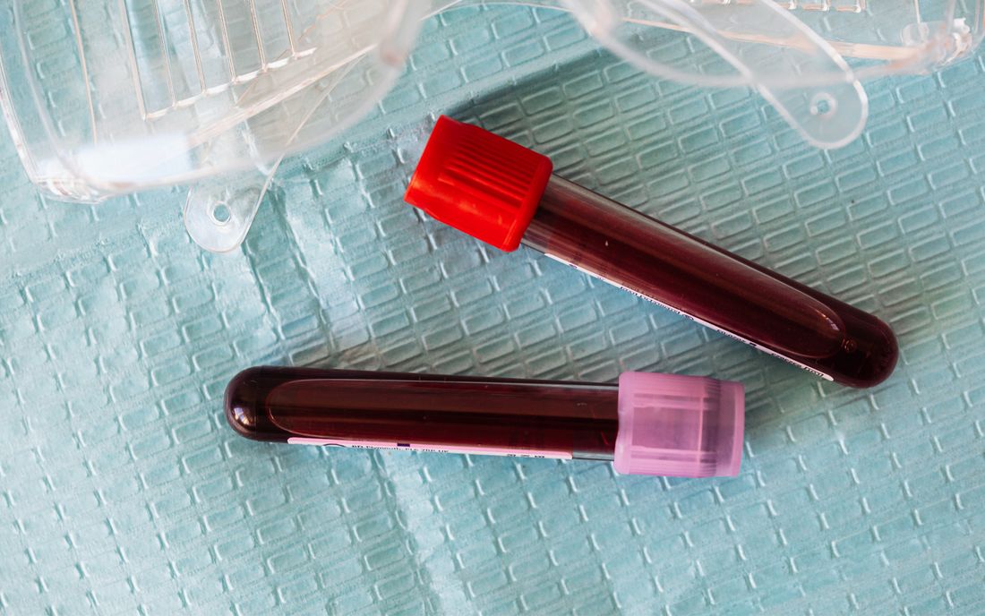 Blood Test Tubes